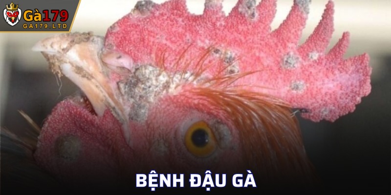 Bệnh Đậu Gà
